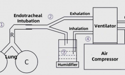 Workflow of a Ventilator