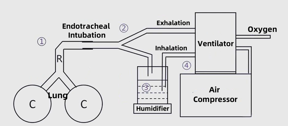 Workflow of a Ventilator