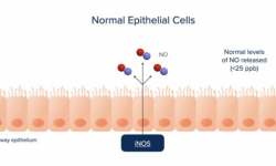 Nitric Oxide Breath NO